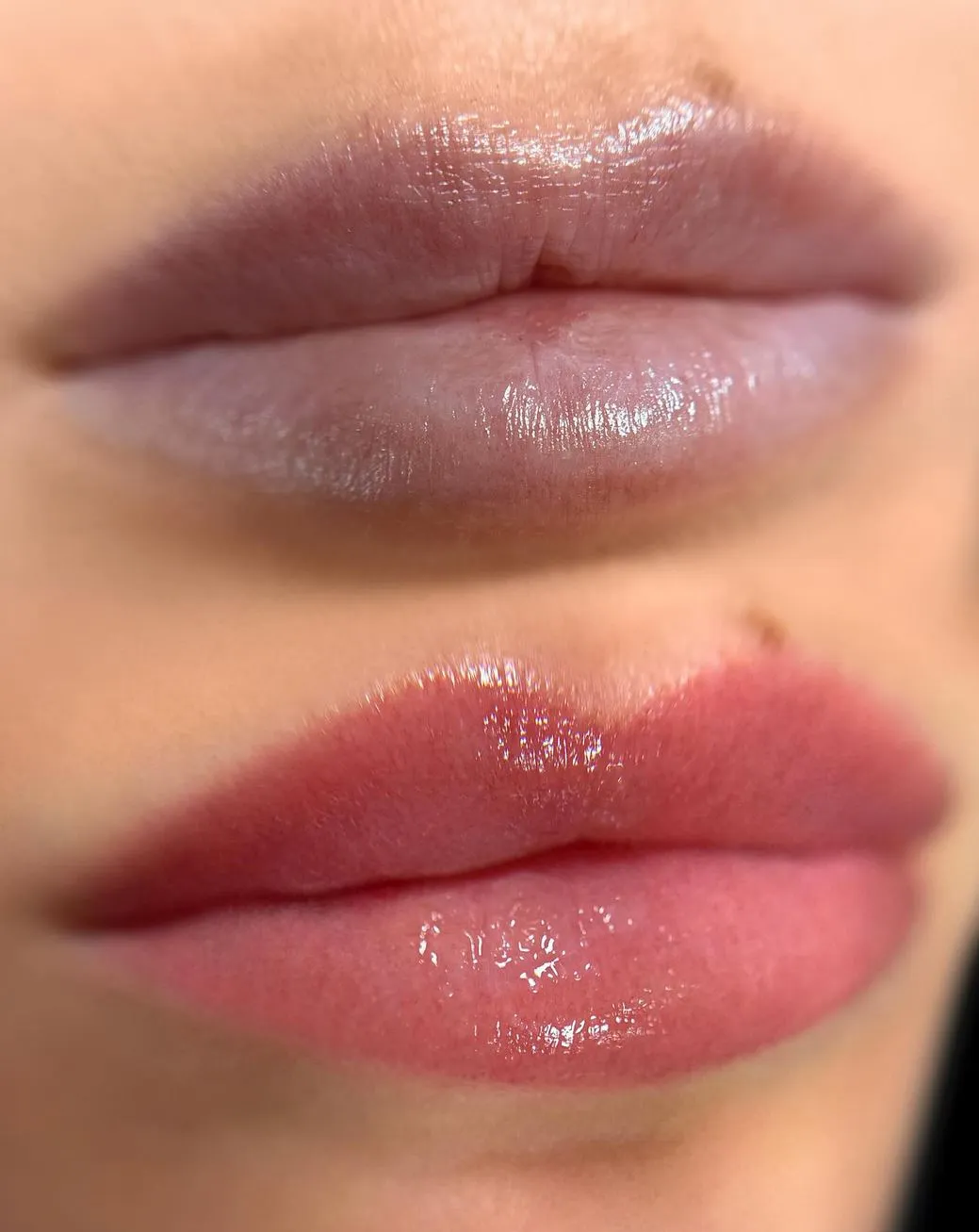 Cold Sores After Blush