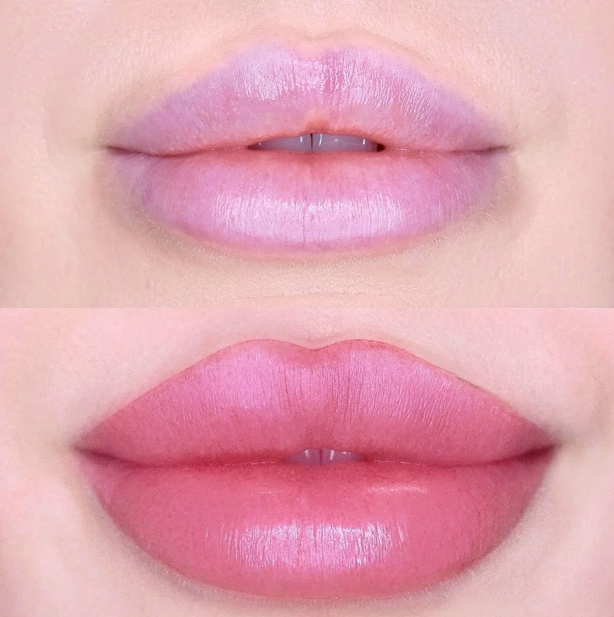 How to Prevent Cold Sores