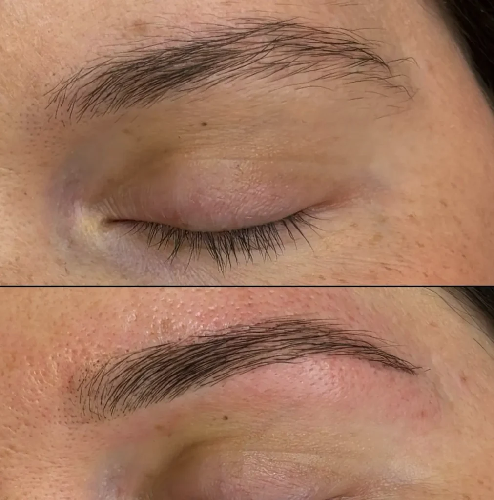 Let the Brows Rest Easy