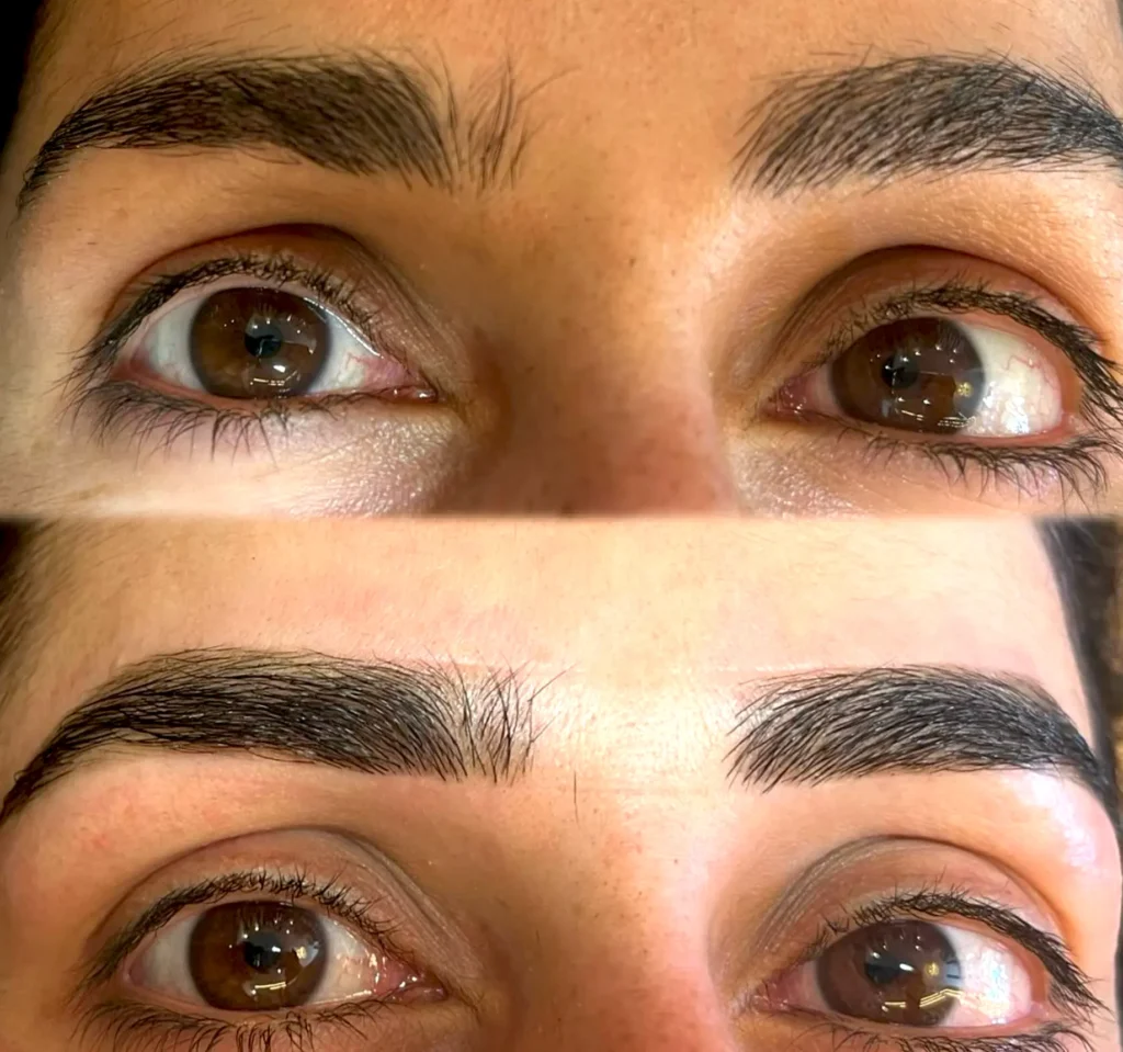 Melbourne Skin Types and Why They Matter