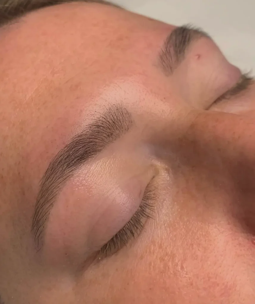 Tricks from the Treatment Room